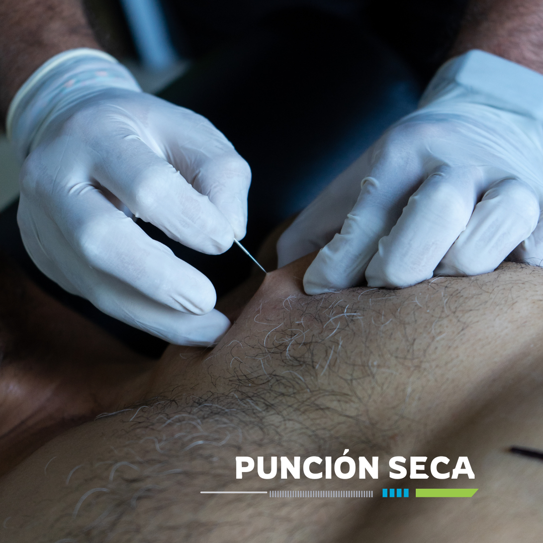 Servicios de fisioterapia